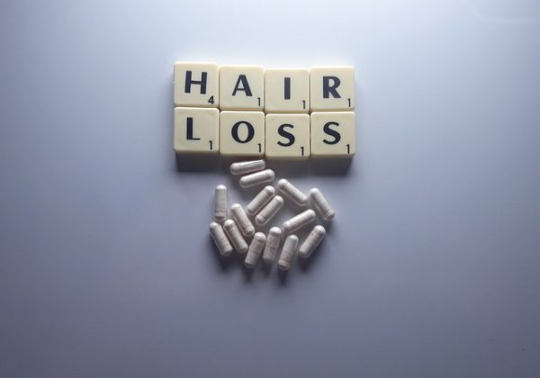 נוטלים מינוקסידיל לטיפול בנשירת שיער? כדאי שתכירו גם את תופעות הלוואי